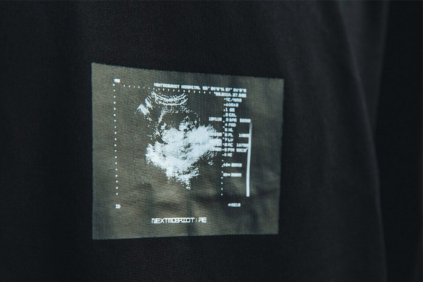 NextMobRiot 19 SS Ultrasound Scan OVS Photo tee (6)
